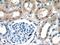 TSC Complex Subunit 2 antibody, 20004-1-AP, Proteintech Group, Immunohistochemistry paraffin image 