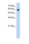 Stress Induced Phosphoprotein 1 antibody, NBP1-57837, Novus Biologicals, Western Blot image 