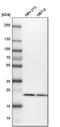 RAB7A, Member RAS Oncogene Family antibody, PA5-52369, Invitrogen Antibodies, Western Blot image 