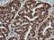 Protein Tyrosine Kinase 2 antibody, NBP2-45923, Novus Biologicals, Immunohistochemistry frozen image 