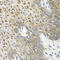 Cyclin Dependent Kinase 1 antibody, LS-C746813, Lifespan Biosciences, Immunohistochemistry paraffin image 