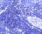 SATB Homeobox 1 antibody, NBP2-67371, Novus Biologicals, Immunohistochemistry paraffin image 