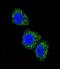 Menin 1 antibody, abx033383, Abbexa, Western Blot image 