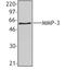 Matrix Metallopeptidase 3 antibody, TA327947, Origene, Western Blot image 