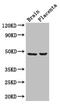CD177 Molecule antibody, CSB-PA850816LA01HU, Cusabio, Western Blot image 
