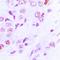 Lysine Acetyltransferase 2A antibody, orb216116, Biorbyt, Immunohistochemistry paraffin image 