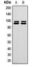 Microtubule-associated serine/threonine-protein kinase-like antibody, MBS8225930, MyBioSource, Western Blot image 