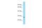 Nudix Hydrolase 7 antibody, PA5-70718, Invitrogen Antibodies, Western Blot image 