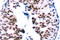 Signal Transducer And Activator Of Transcription 5A antibody, LS-C177957, Lifespan Biosciences, Immunohistochemistry paraffin image 