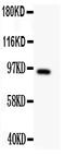 DISC1 Scaffold Protein antibody, PA2023-1, Boster Biological Technology, Western Blot image 