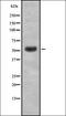 Regulator Of G Protein Signaling 9 antibody, orb336957, Biorbyt, Western Blot image 