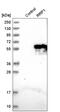 Ribosomal RNA Processing 1 antibody, HPA018166, Atlas Antibodies, Western Blot image 