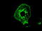 Fermitin Family Member 2 antibody, LS-C784327, Lifespan Biosciences, Immunofluorescence image 