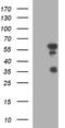 Interferon Regulatory Factor 5 antibody, NBP2-45425, Novus Biologicals, Western Blot image 