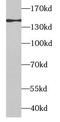 Apoptotic Peptidase Activating Factor 1 antibody, FNab00470, FineTest, Western Blot image 