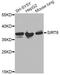 Annexin A2 antibody, A12397, ABclonal Technology, Western Blot image 