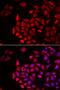 COCH antibody, 22-314, ProSci, Immunofluorescence image 