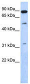 SUMO Specific Peptidase 5 antibody, TA329775, Origene, Western Blot image 