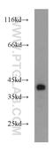 SH3 Domain Containing GRB2 Like, Endophilin B1 antibody, 15422-1-AP, Proteintech Group, Western Blot image 