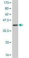 Calcium/calmodulin-dependent protein kinase type 1 antibody, H00008536-M02, Novus Biologicals, Western Blot image 