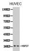 Inhibitor Of Nuclear Factor Kappa B Kinase Subunit Epsilon antibody, LS-C192671, Lifespan Biosciences, Western Blot image 