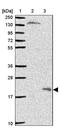LDOC1 Regulator Of NFKB Signaling antibody, PA5-62475, Invitrogen Antibodies, Western Blot image 