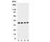 Eukaryotic Translation Initiation Factor 2 Subunit Alpha antibody, R31138, NSJ Bioreagents, Western Blot image 