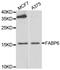 Fatty Acid Binding Protein 6 antibody, STJ28986, St John