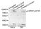 B-Raf Proto-Oncogene, Serine/Threonine Kinase antibody, STJ29342, St John