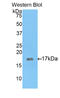 Glutamate Decarboxylase 1 antibody, LS-C299751, Lifespan Biosciences, Western Blot image 
