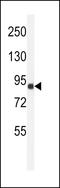 Ankyrin Repeat Domain 49 antibody, LS-C156371, Lifespan Biosciences, Western Blot image 