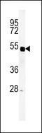 Sp5 Transcription Factor antibody, LS-C161411, Lifespan Biosciences, Western Blot image 