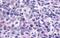 C-X-C Motif Chemokine Receptor 1 antibody, GTX70707, GeneTex, Immunohistochemistry paraffin image 