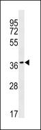 Ras-related protein Rab-36 antibody, LS-C158789, Lifespan Biosciences, Western Blot image 