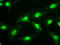 Small RNA Binding Exonuclease Protection Factor La antibody, GTX83557, GeneTex, Immunocytochemistry image 