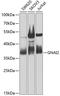 G Protein Subunit Alpha I2 antibody, 15-425, ProSci, Western Blot image 