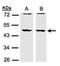 Drebrin Like antibody, GTX106288, GeneTex, Western Blot image 