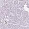 Stromal Cell Derived Factor 4 antibody, PA5-52809, Invitrogen Antibodies, Immunohistochemistry paraffin image 