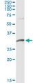 Dynein Axonemal Light Intermediate Chain 1 antibody, LS-C198497, Lifespan Biosciences, Immunoprecipitation image 