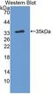 Bridging Integrator 2 antibody, LS-C689171, Lifespan Biosciences, Western Blot image 