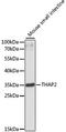 THAP Domain Containing 2 antibody, A3518, ABclonal Technology, Western Blot image 