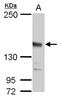 Jumonji And AT-Rich Interaction Domain Containing 2 antibody, PA5-78031, Invitrogen Antibodies, Western Blot image 