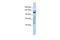 Zinc Finger Protein 451 antibody, A08925, Boster Biological Technology, Western Blot image 