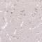 ABR Activator Of RhoGEF And GTPase antibody, HPA054824, Atlas Antibodies, Immunohistochemistry paraffin image 