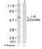 LCK Proto-Oncogene, Src Family Tyrosine Kinase antibody, GTX38561, GeneTex, Western Blot image 