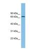 Glutamate Dehydrogenase 2 antibody, NBP1-57732, Novus Biologicals, Western Blot image 