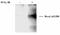 BRCA1 DNA Repair Associated antibody, NB100-224, Novus Biologicals, Western Blot image 