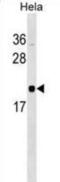 RWD Domain Containing 1 antibody, abx029651, Abbexa, Western Blot image 