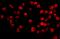 Apoptotic Chromatin Condensation Inducer 1 antibody, 2217, ProSci, Immunofluorescence image 