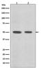 Desmin antibody, M01948-1, Boster Biological Technology, Western Blot image 
